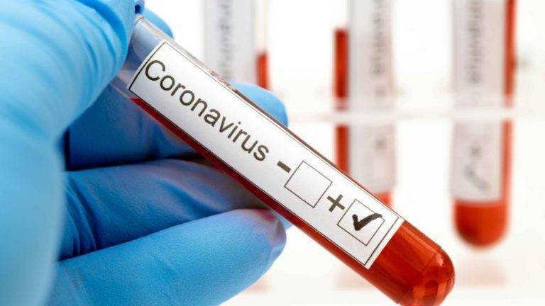 Sube a 20 los casos positivos por Coronavirus en Tamaulipas