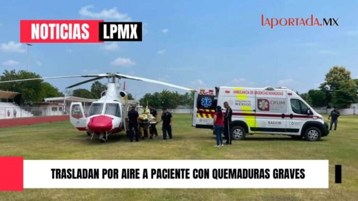 LPMX
